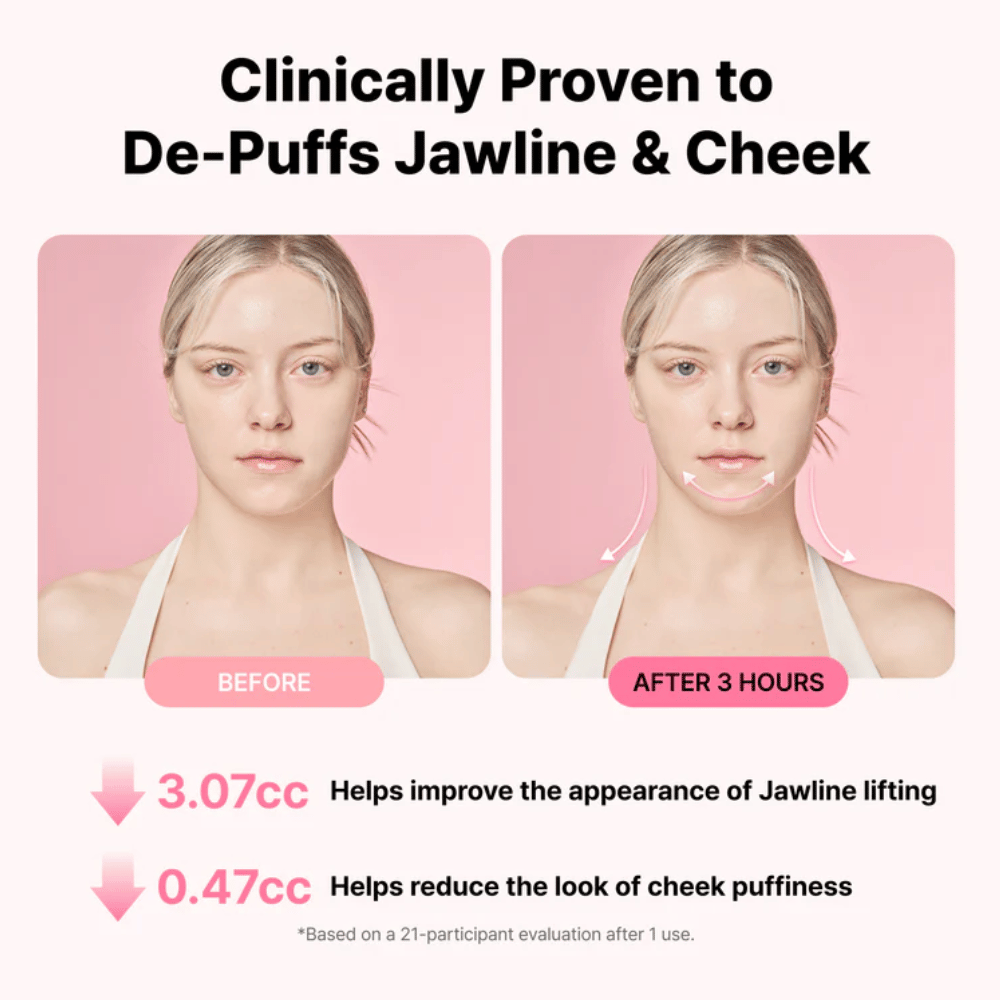 Vorher-Nachher-Bild, das ein verbessertes Erscheinungsbild der Kieferlinie und eine verringerte Schwellung nach der Anwendung von RETURNITY Ear Therapy Acupressure Patch über drei Stunden veranschaulicht.
