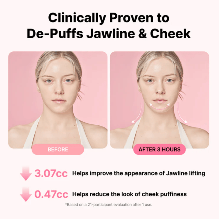 Vorher-Nachher-Bild, das ein verbessertes Erscheinungsbild der Kieferlinie und eine verringerte Schwellung nach der Anwendung von RETURNITY Ear Therapy Acupressure Patch über drei Stunden veranschaulicht.