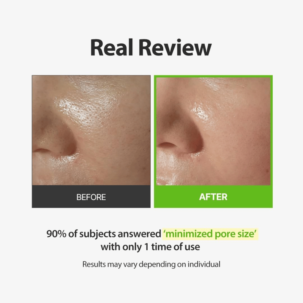 SUNGBOON EDITOR Green Tomato Pore Peeling Jumbo Pad – Vorher-Nachher-Bild mit Fokus auf sichtbare Poren