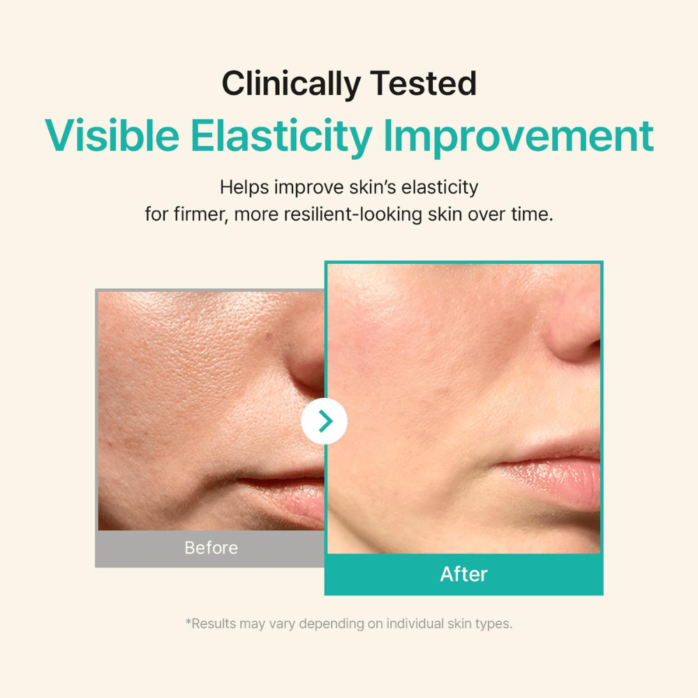 Vorher-Nachher-Bild, das eine verbesserte Hautelastizität und straffere Haut nach der Anwendung des Serums zeigt.