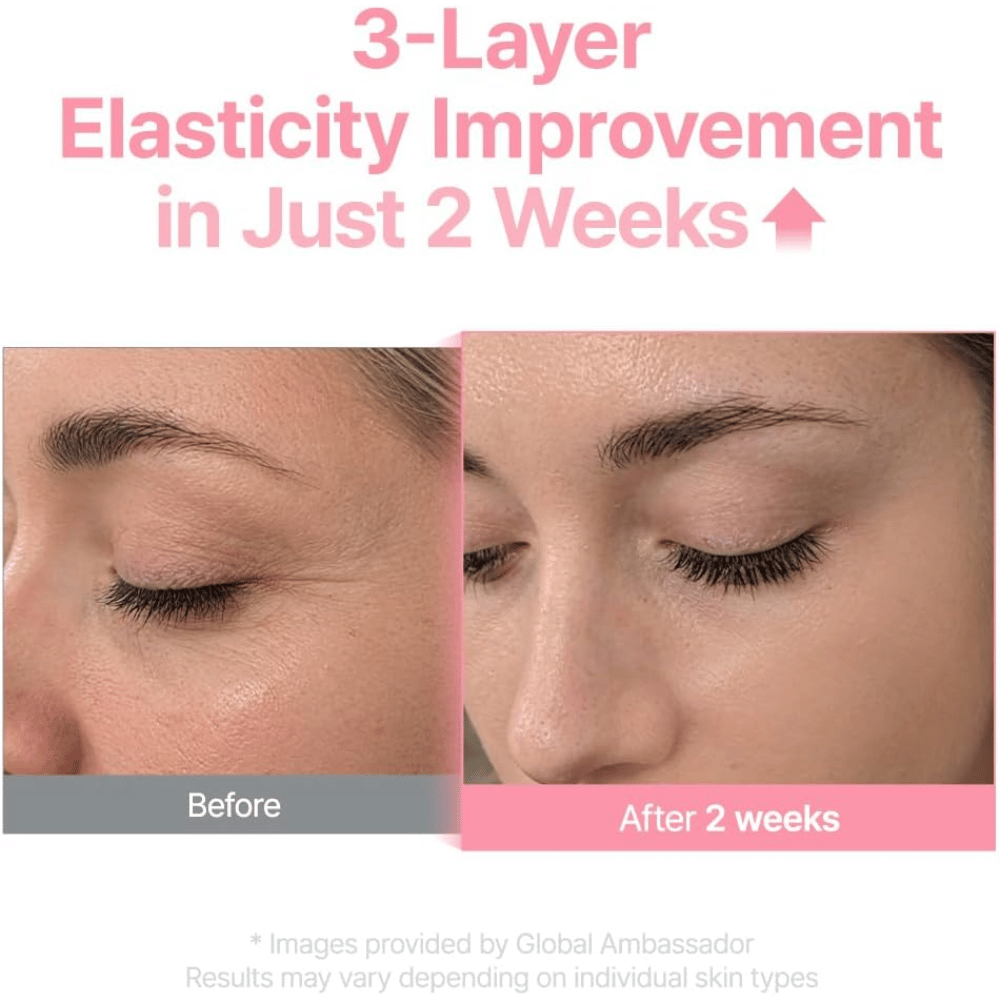 Vorher- und Nachherbild für Purito Multi PDRN Collagen EGF Serum, das eine verbesserte Hautelastizität nach zwei Wochen zeigt.